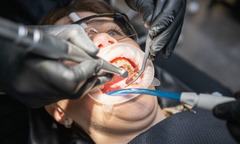 Coroane dentare